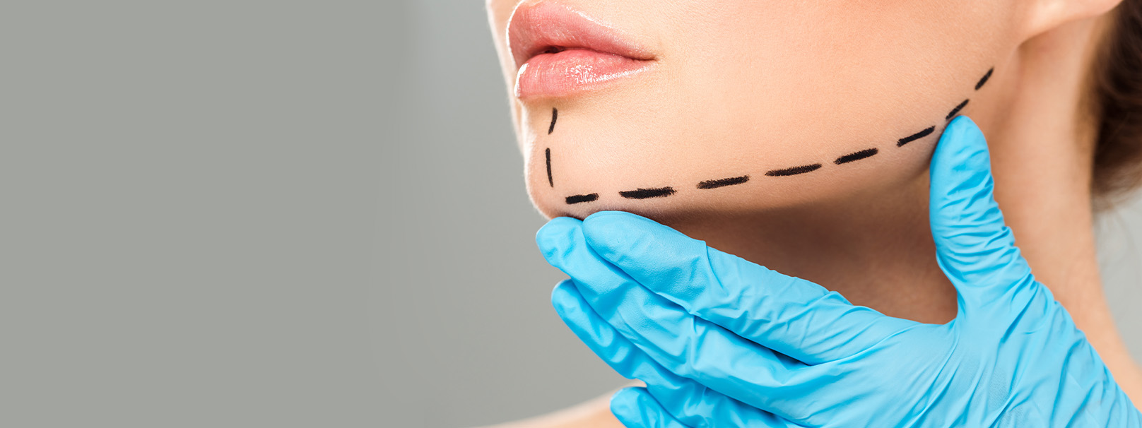 Plastische Chirurgie in der Türkei